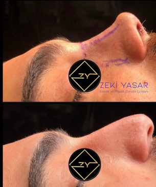 Slider image (7) Dr. Zeki Yasar Clinic